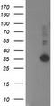 Sirtuin 5 antibody, TA503283, Origene, Western Blot image 