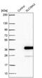 Solute Carrier Family 39 Member 3 antibody, PA5-59886, Invitrogen Antibodies, Western Blot image 