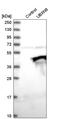 UBX Domain Protein 8 antibody, HPA017725, Atlas Antibodies, Western Blot image 