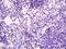 Alkaline Phosphatase, Germ Cell antibody, orb312168, Biorbyt, Immunohistochemistry paraffin image 