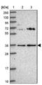BTB/POZ domain-containing protein KCTD15 antibody, NBP2-14148, Novus Biologicals, Western Blot image 
