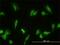 Glomulin, FKBP Associated Protein antibody, H00011146-M01, Novus Biologicals, Immunofluorescence image 