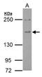 Epidermal Growth Factor Receptor Pathway Substrate 15 antibody, NBP2-16356, Novus Biologicals, Western Blot image 