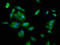 Plectin antibody, LS-C673576, Lifespan Biosciences, Immunofluorescence image 