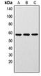 LYN Proto-Oncogene, Src Family Tyrosine Kinase antibody, orb256662, Biorbyt, Western Blot image 