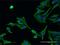 Alsin Rho Guanine Nucleotide Exchange Factor ALS2 antibody, H00057679-M02, Novus Biologicals, Immunocytochemistry image 