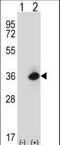 MOK Protein Kinase antibody, LS-C164566, Lifespan Biosciences, Western Blot image 