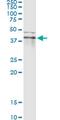 Ring Finger Protein 113B antibody, MA5-23047, Invitrogen Antibodies, Immunoprecipitation image 