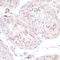 Plasmalemma vesicle-associated protein antibody, HPA002279, Atlas Antibodies, Immunohistochemistry paraffin image 