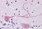 Mesencephalic Astrocyte Derived Neurotrophic Factor antibody, MBS242565, MyBioSource, Immunohistochemistry frozen image 