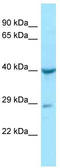 Alpha-N-acetylgalactosaminidase antibody, TA343289, Origene, Western Blot image 