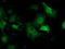 Phenylethanolamine N-methyltransferase antibody, LS-C172944, Lifespan Biosciences, Immunofluorescence image 