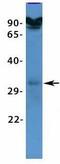 Voltage Dependent Anion Channel 3 antibody, GTX47682, GeneTex, Western Blot image 