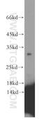 Crystallin Beta B1 antibody, 13760-1-AP, Proteintech Group, Western Blot image 