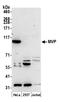 Major Vault Protein antibody, A305-213A, Bethyl Labs, Western Blot image 