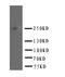 ATP Binding Cassette Subfamily A Member 4 antibody, PA2065, Boster Biological Technology, Western Blot image 