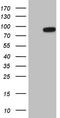 Heat Shock Transcription Factor 2 antibody, TA807434S, Origene, Western Blot image 
