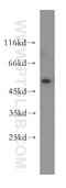 Thymidine Phosphorylase antibody, 12383-1-AP, Proteintech Group, Western Blot image 