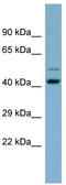 Zinc Finger Protein 506 antibody, TA342456, Origene, Western Blot image 