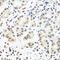 Insulin Like Growth Factor 2 MRNA Binding Protein 1 antibody, 15-913, ProSci, Immunohistochemistry paraffin image 
