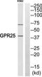 G Protein-Coupled Receptor 25 antibody, TA313948, Origene, Western Blot image 