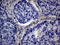 PMP-22 antibody, LS-C791853, Lifespan Biosciences, Immunohistochemistry paraffin image 