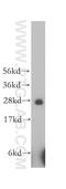 Heparan Sulfate 2-O-Sulfotransferase 1 antibody, 12453-1-AP, Proteintech Group, Western Blot image 