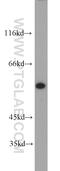 PTAC58 antibody, 10819-1-AP, Proteintech Group, Western Blot image 