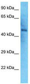NIMA Related Kinase 2 antibody, TA346712, Origene, Western Blot image 