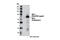 NPL4 Homolog, Ubiquitin Recognition Factor antibody, 13489S, Cell Signaling Technology, Western Blot image 