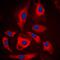 Steroid 5 Alpha-Reductase 2 antibody, orb101414, Biorbyt, Immunofluorescence image 