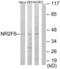 Nuclear Receptor Subfamily 2 Group F Member 6 antibody, LS-C118774, Lifespan Biosciences, Western Blot image 