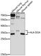 Major Histocompatibility Complex, Class II, DO Alpha antibody, 15-957, ProSci, Western Blot image 