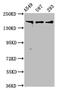 Agrin antibody, CSB-PA001461LA01HU, Cusabio, Western Blot image 