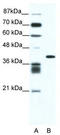 ALX Homeobox 4 antibody, TA331783, Origene, Western Blot image 