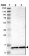 Cysteine Rich DPF Motif Domain Containing 1 antibody, NBP1-81297, Novus Biologicals, Western Blot image 