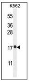 Ribosomal Protein L27a antibody, AP53714PU-N, Origene, Western Blot image 