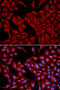 Dynactin Subunit 2 antibody, 18-570, ProSci, Immunofluorescence image 