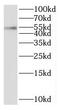 Protein Phosphatase, Mg2+/Mn2+ Dependent 1B antibody, FNab06685, FineTest, Western Blot image 