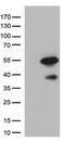 Pancreatic And Duodenal Homeobox 1 antibody, NBP2-46371, Novus Biologicals, Western Blot image 