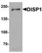 Protein dispatched homolog 1 antibody, A11542, Boster Biological Technology, Western Blot image 