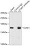 CARP1 antibody, GTX33069, GeneTex, Immunoprecipitation image 