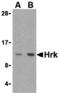 Harakiri, BCL2 Interacting Protein antibody, MBS151175, MyBioSource, Western Blot image 