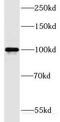 DNM2 antibody, FNab02479, FineTest, Western Blot image 