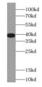 Eukaryotic Translation Elongation Factor 1 Delta antibody, FNab02647, FineTest, Western Blot image 