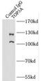 DNA Topoisomerase III Alpha antibody, FNab08870, FineTest, Immunoprecipitation image 