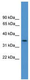 Chromosome 4 Open Reading Frame 19 antibody, TA344153, Origene, Western Blot image 