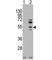 Myocyte Enhancer Factor 2C antibody, F49561-0.4ML, NSJ Bioreagents, Western Blot image 