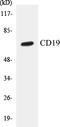 CD19 antibody, EKC1097, Boster Biological Technology, Western Blot image 