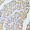 Striatin-3 antibody, A06672, Boster Biological Technology, Immunohistochemistry paraffin image 